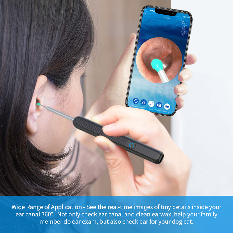 NE3 Ear Cleaner Otoscope