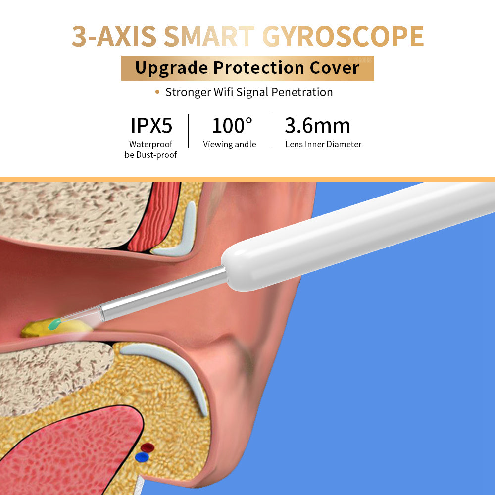 NE3 Ear Cleaner Otoscope